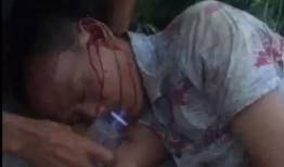 男子爆料医院惩罚视频,男子揭露惊人内幕